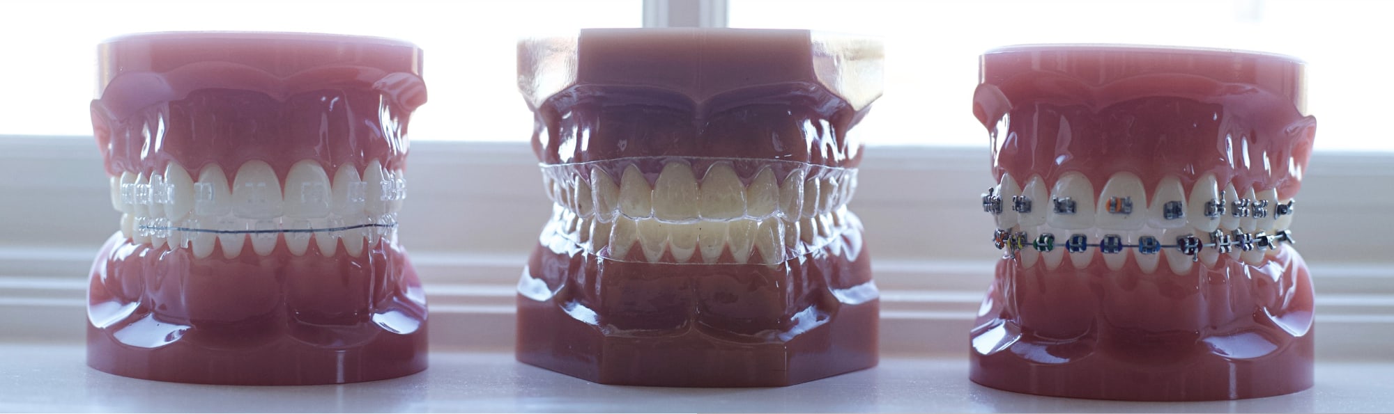 various types of aligners on plastic models